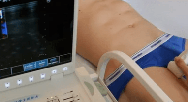 Diagnostic options for varicose veins of the lower extremities